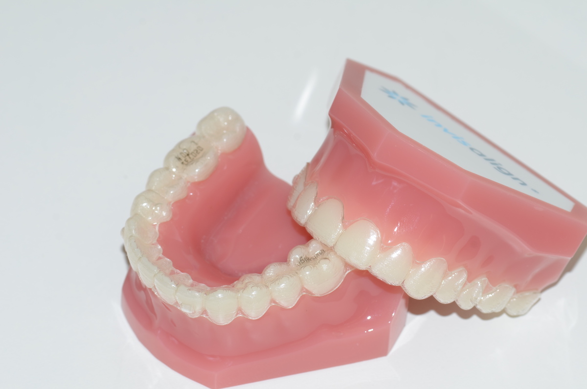 Impressão 3D na ortodontia