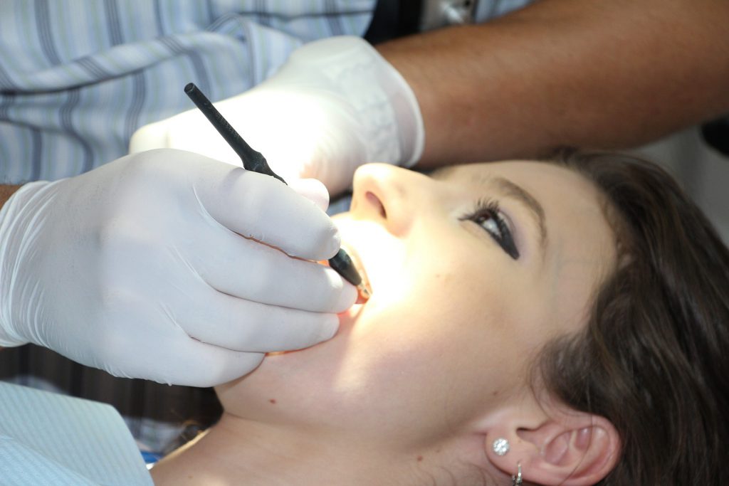Tratamento para manchas nos dentes causadas por aparelhos
